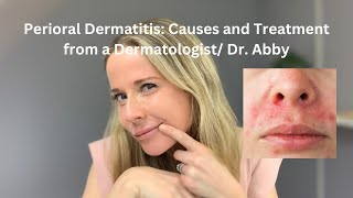 Perioral dermatitis causes and treatment from a Dermatologist [upl. by Hagerman]