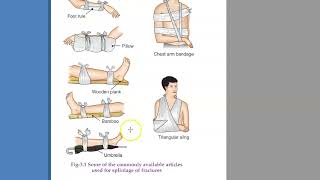 Orthopedics 044 Splinting [upl. by Creigh]