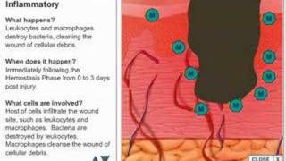 Wound Healing Process [upl. by Ronald825]