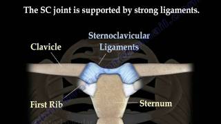 Sternoclavicular joint Dislocations  Everything You Need To Know  Dr Nabil Ebraheim [upl. by Aissac]