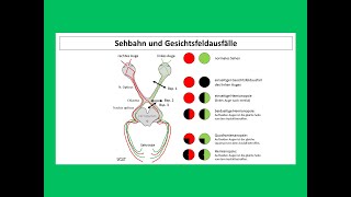 Sehbahn und Gesichtsausfälle  Strahlentherapie Prof Hilke Vorwerk [upl. by Kipp823]