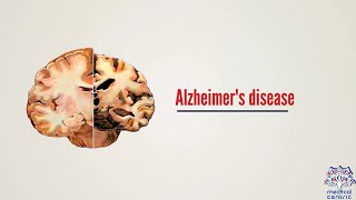 What is Alzheimers disease Causes Signs and Symptoms Diagnosis and Treatment [upl. by Eitteb53]