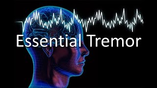 Essential Tremor [upl. by Jonati]