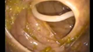 Ascaris Lumbricoides MICROBIOLOGIA Clase Mariella3 [upl. by Burdett]