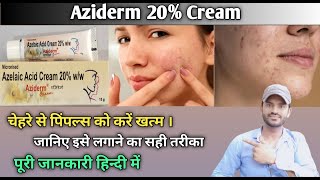 Aziderm 20 cream use benefits and side effects full review in hindi [upl. by Oiliduab768]