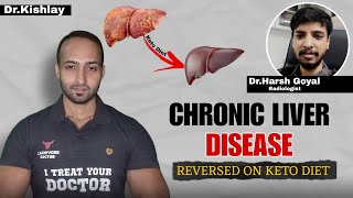 Chronic Liver Disease patient in decompensated stage reversed to normal liver function on keto diet [upl. by Donaugh760]