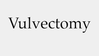 How to Pronounce Vulvectomy [upl. by Yssenhguahs]