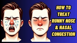 How To Stop Runny Nose  Runny Nose Home Remedy  Runny Nose Treatment [upl. by Asenev358]