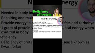 Kwashiorkor  Protein deficiency disease deficiencyofprotein [upl. by Narat]