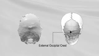 OCCIPITAL BONE [upl. by Aeiram]