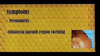 Acute parotitis in neonates Patient teaching programme Tamil [upl. by Meeharbi240]