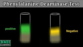 Phenylalanine Deaminase Test [upl. by Ioyal513]