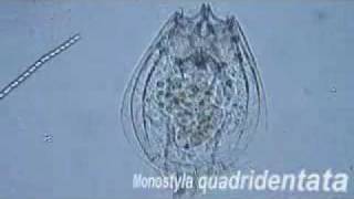 Monostyla quadridentata Zooplankton Rotifer [upl. by Pinckney]