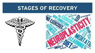 The 2Stage Recovery Process for Vestibular Disorders [upl. by Hibbert]