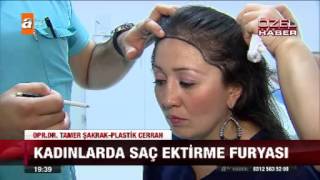 Kadınlarda saç ektirme furyası  24102015  atv Ana Haber [upl. by Bord]