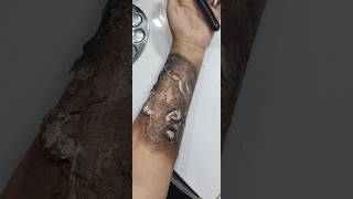 Prosthetic burn hand makeuptutorial makeupvideo youtubeshorts shortsvideo makeupshorts [upl. by Hey]