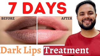 7 Days Dark Lips Removal Challenge  Pigmented Lips Treatment [upl. by Tabbitha]