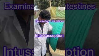 Diagnosis of Intussusception l dr Umar khan [upl. by Yetnom]