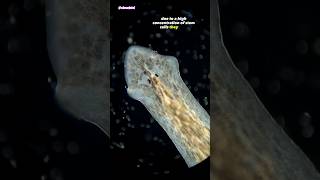 Freshwater Flatworm Under Microscope Planarian [upl. by Tench]