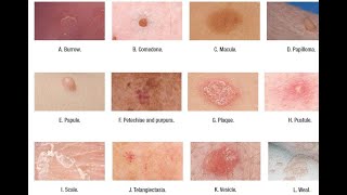 Skin Lesions with defination [upl. by Loos]