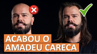 FIZ IMPLANTE CABELO  BASTIDORES DA CIRURGIA COM O DR THIAGO BIANCO [upl. by Eugenia468]