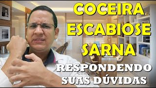 Tire todas as suas dúvidas sobre Escabiose Sarna e Coceiras em geral [upl. by Meesak211]