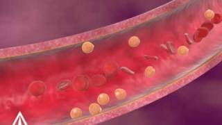 Cholesterol  3D Medical Animation [upl. by Elledoj642]