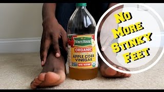 How To Get Rid Of Foot Odor Apple Cider Vinegar [upl. by Mayfield]