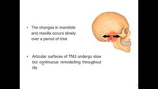 TMJ DYSFUNCTION [upl. by Roath994]