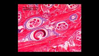 ORGANISM SLIDE Trichinella spiralis Microscope Slide [upl. by Margaretta]