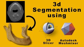 3D Segmentation Workshop  Dicom to STL model using 3D slicer [upl. by Gnol]