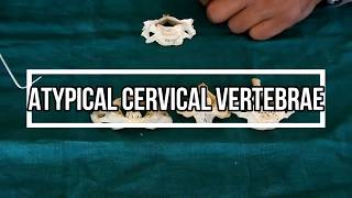 Atypical Cervical Vertebrae [upl. by Vahe]