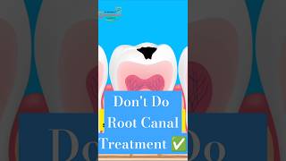 🚫 Don’t Do Root Canal Treatment unless it’s absolutely necessary 🦷 nashik rct rootcanal [upl. by Hsaka]