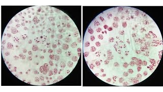 LeptoteneZygotenePachyteneDiplotene amp Diakinesis stages of meiosis with identifying characters [upl. by Ailemrac]