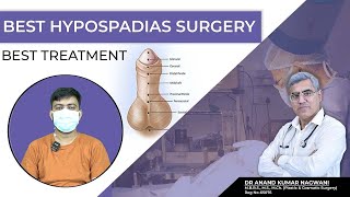 Best Hypospadias Surgeon in Kolkata  मूत्र का छिद्र सही जगह पर न खुलने की समस्या  Dr Nagwani [upl. by Madella]