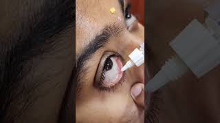 Simple Steps to Apply Eye Ointment eyeawareness eyeclinic mogappair ophthalmologist eyecare [upl. by Brower549]