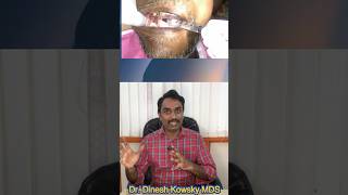 சொத்தை பல் வலி சிகிச்சை  Tooth pain treatment [upl. by Cross]