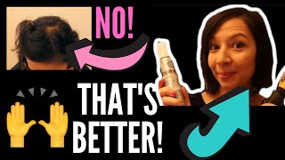 MORNING GRWM ROGAINE HAIR STYLING ROUTINE Putting on makeup and covering up thin and balding spots [upl. by Heppman]