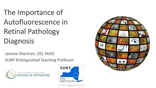 The Importance of Autofluorescence in Retinal Pathology Diagnosis [upl. by Harewood]