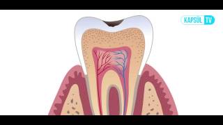 Diş Hangi Durumlarda Çekilir [upl. by Kcuhc991]