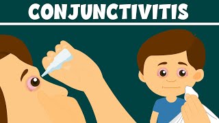 Conjunctivitis What Is Pink Eye  Types Symptoms and Treatment  Video for Kids [upl. by Matrona930]