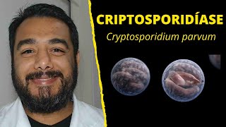 Criptosporidíase Cryptosporidium parvum  Curso de Parasitologia Humana Básica e Clínica [upl. by Odrarej369]