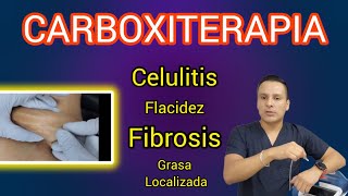 Carboxiterapia  Celulitis flacidez fibrosis Grasa Localizada  Aplicación [upl. by Celin993]