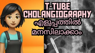 TTUBE CHOLANGIOGRAPHY Complete study explained in Malayalam [upl. by Raamaj]