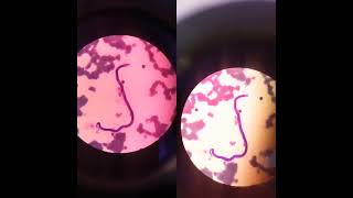 Microfilaria in blood parasitology parasite worms [upl. by Arley]