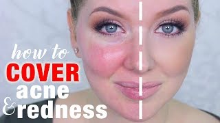 How to Cover Acne amp Redness  DRUGSTORE Makeup [upl. by Ofelia]