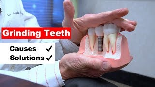 Grinding Teeth Bruxism  A Major Cause of Gum Recession [upl. by Cailly]