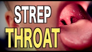 What are the signs and symptoms of strep throat [upl. by Goetz488]