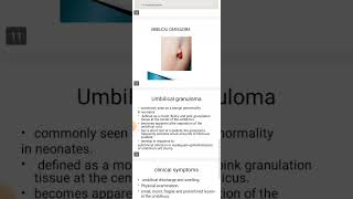 Umbilical diseases  Hernia and granuloma [upl. by Etteuqal]