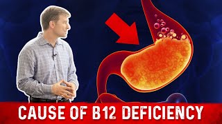 Vitamin B12 Deficiency The most common Cause – Dr Berg [upl. by Yank]